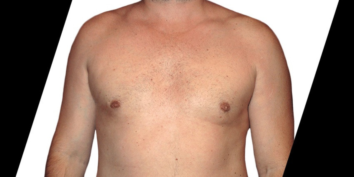 How to Prepare for Your First Vaser Liposuction Houston TX Consultation