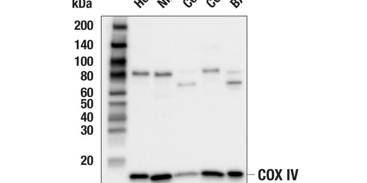 Understanding COX IV Antibody: A Key Tool for Mitochondrial Research and Disease Diagnosis