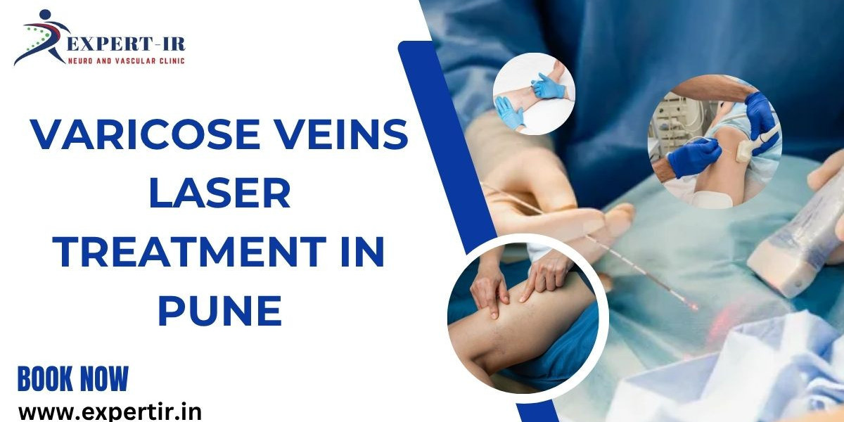 Varicose Veins Laser Treatment in Pune – A Modern & Effective Solution