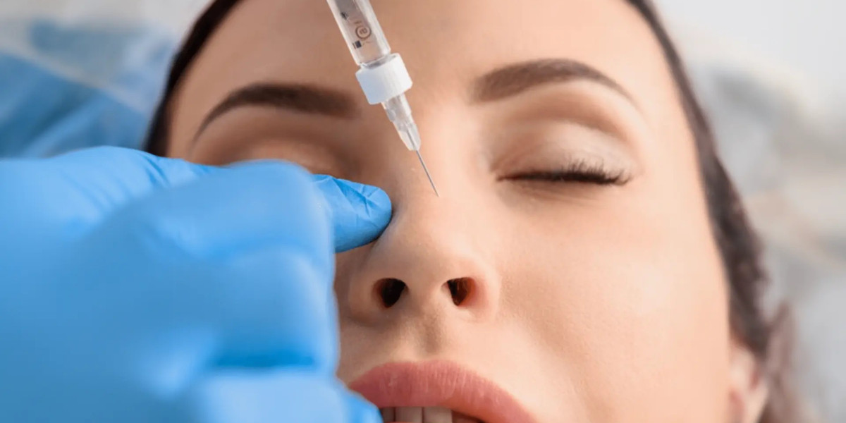 Nose Filler Thornhill A Smooth Path to a More Balanced Profile