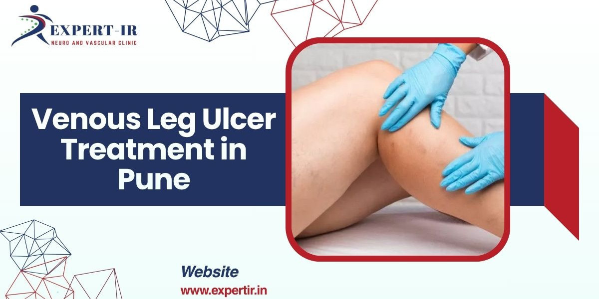 Best Solutions for Fast Recovery: Venous Leg Ulcer Treatment in Pune