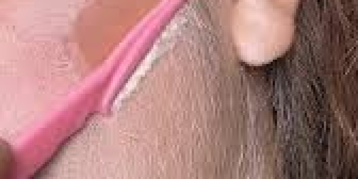 Women Facial Hair Removal Device Market Regional Insights Highlighting Emerging Opportunities In Asia-Pacific And Latin 