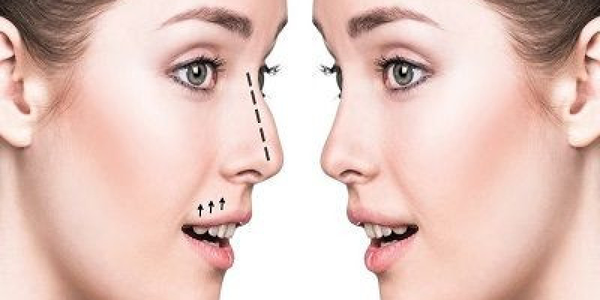 Navigating Rhinoplasty in Islamabad: Enhancing Facial Harmony with Precision and Expertise