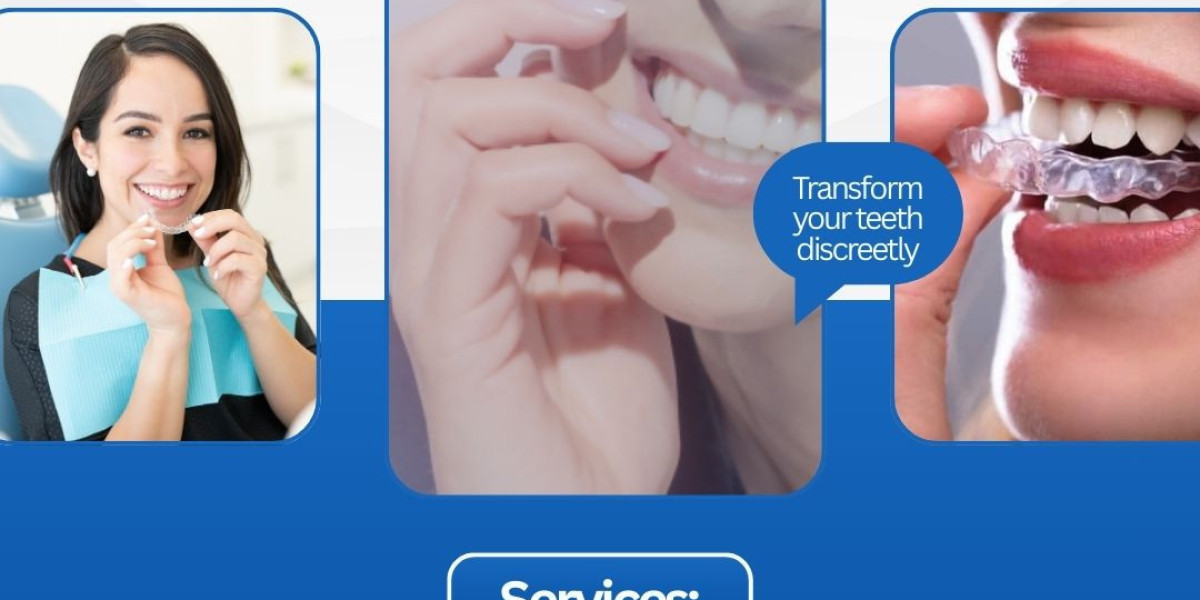 Get Straighter Teeth Discreetly with Smilers Clear Aligners