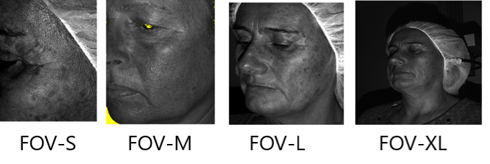 AEVA-HE High End 3D Skin Imaging Technology | 3D Skin Texture Analyzer