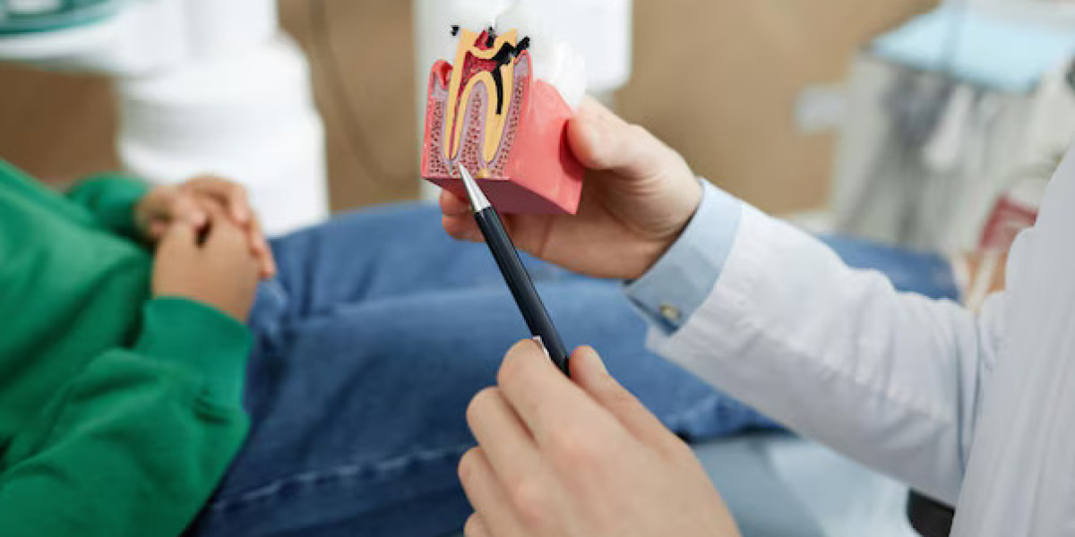The Benefits of Root Canal Therapy: Pain Relief and Long-Term Tooth Protection