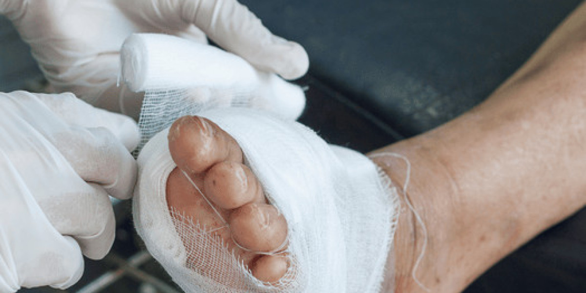 Expert Neuropathy Treatment in Flemington, NJ: Nerve Pain Relief at FYZICAL Therapy & Balance Centers