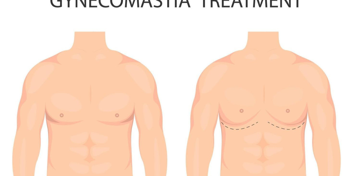 Minimally Invasive Gynecomastia Surgery Techniques