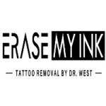 Erase My Ink Profile Picture