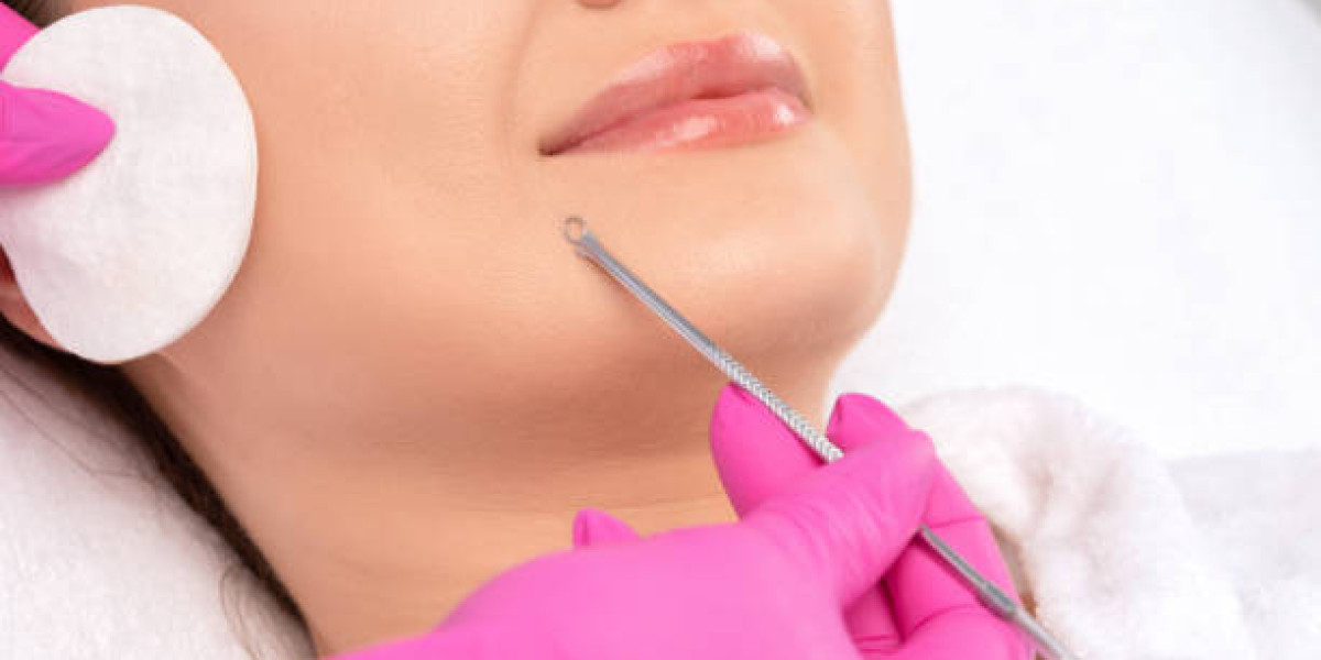 What to Expect During a Deep Cleansing Facial in Riyadh Treatment Session