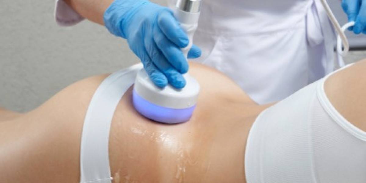 Modern Fat Reduction Solutions for Confident Body Contouring Results