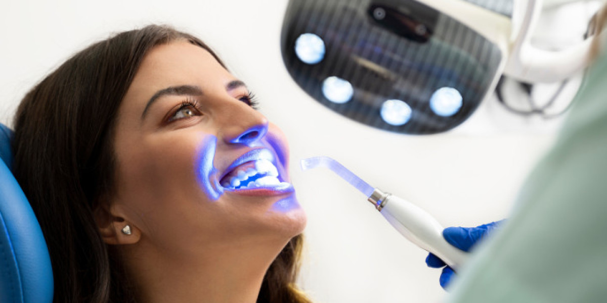 Is Teeth Whitening Safe? Everything You Need to Know
