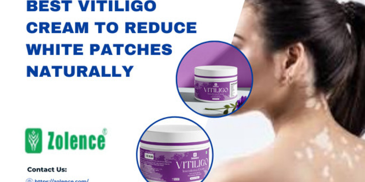 Best Cream For Vitiligo In India