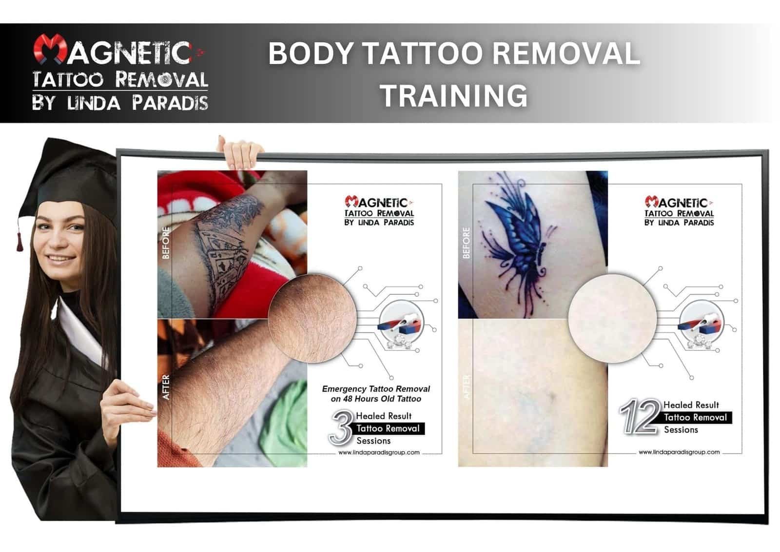 Everything You Need to Know About Online Magnetic Tattoo Removal Training for Professionals - Linda Paradis Group