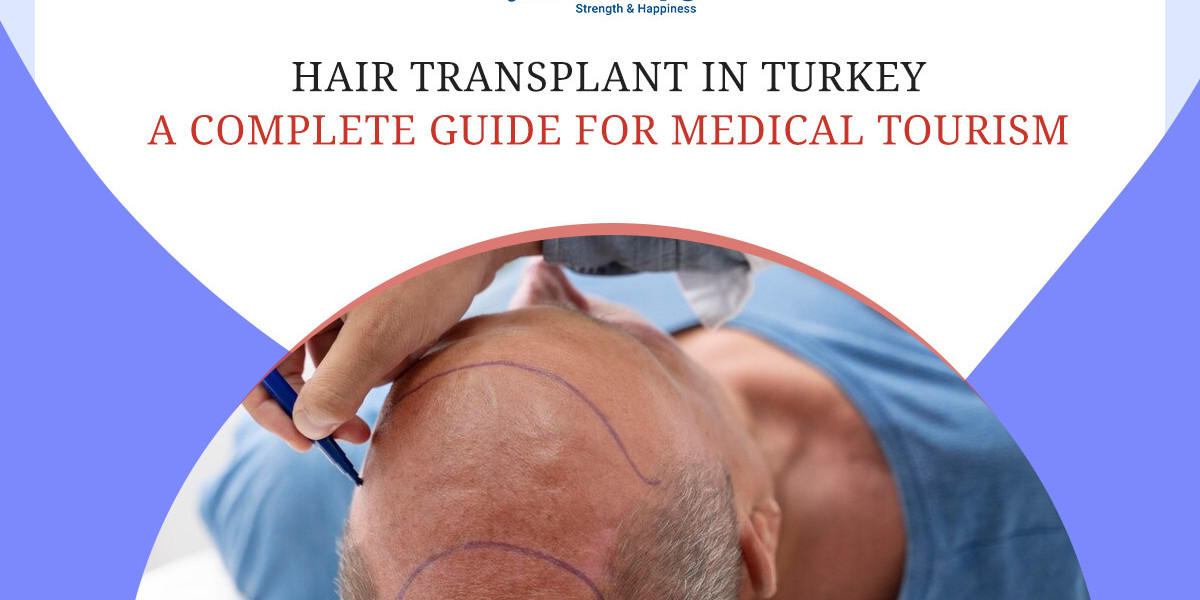 Hair Transplant in Turkey: Affordable, Advanced & Trusted Treatment with EdhaCare