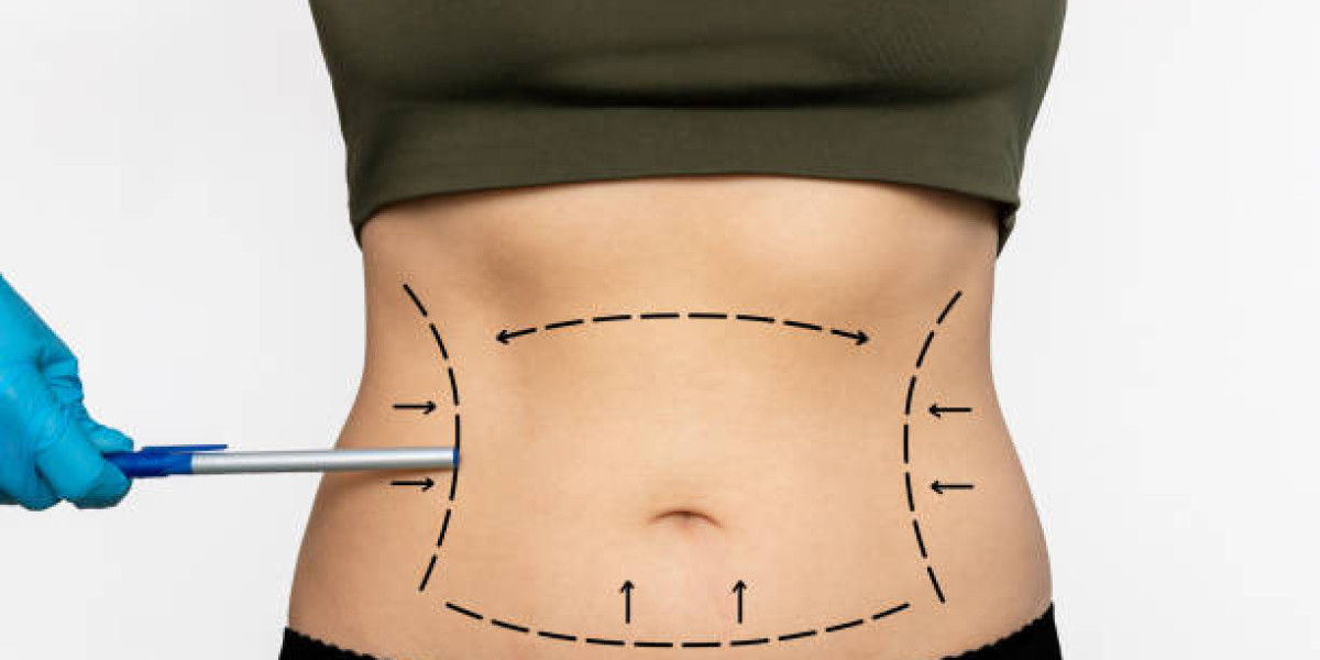 Liposuction Pain Management Strategies During Recovery