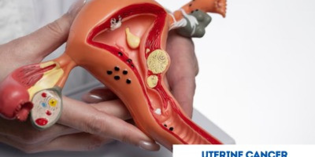 Uterine Cancer Care in India: Combining Medical Excellence with Affordable Treatment