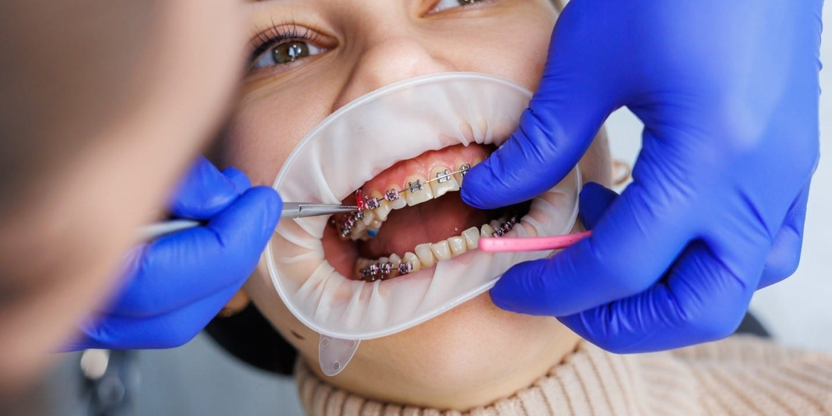 5 Benefits of Visiting Orthodontists in Miami FL for Early Dental Care