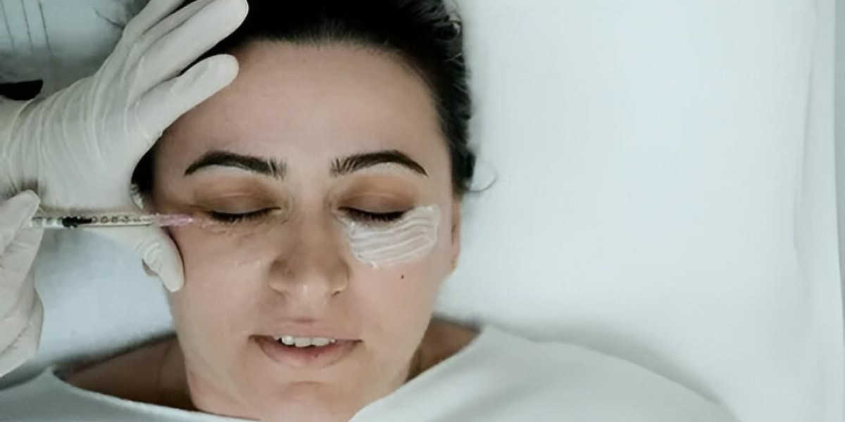 Under Eye Filler Islamabad for Radiant Eyes