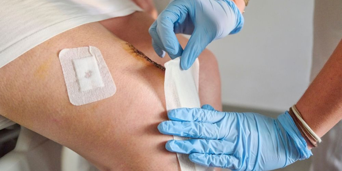 How Advanced Wound Treatment at Home in Troy, MI, Accelerates the Healing Process