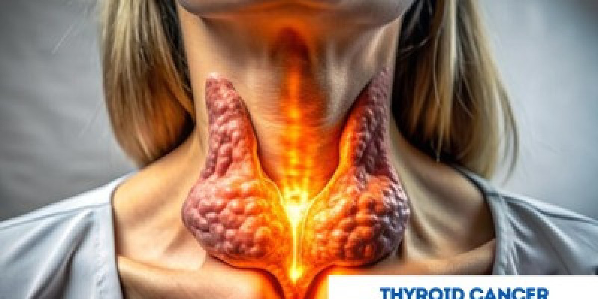 Thyroid Cancer Treatment in India: A Practical Option for Patients from Croatia