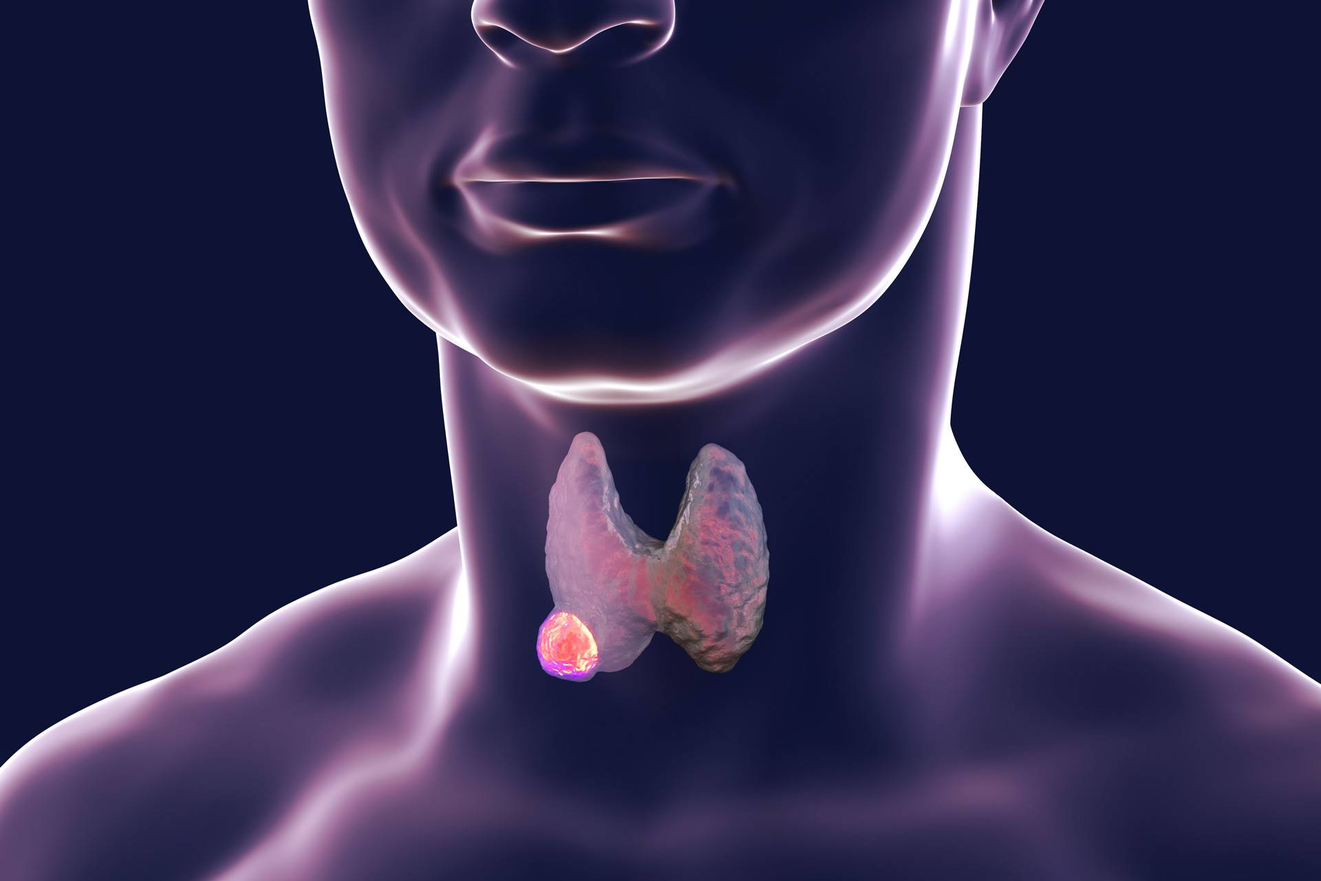 Desiccated Thyroid Explained: What It Is and Who Can Benefit | Expressy