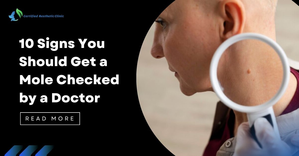 10 Signs You Should Get a Mole Checked by a Doctor