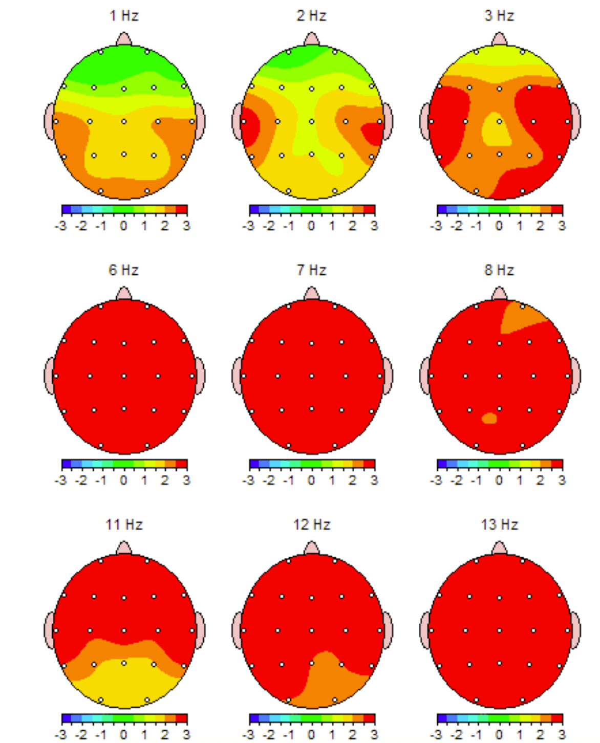 qEEG Brain Mapping | Brain Mapping for Anxiety Tampa