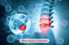 Bone Cancer Treatment | Causes, Symptoms And Types
