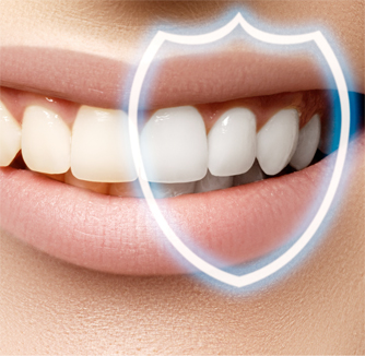 Dental Implants South East London | Teeth Whitening & Orthodontics South East London