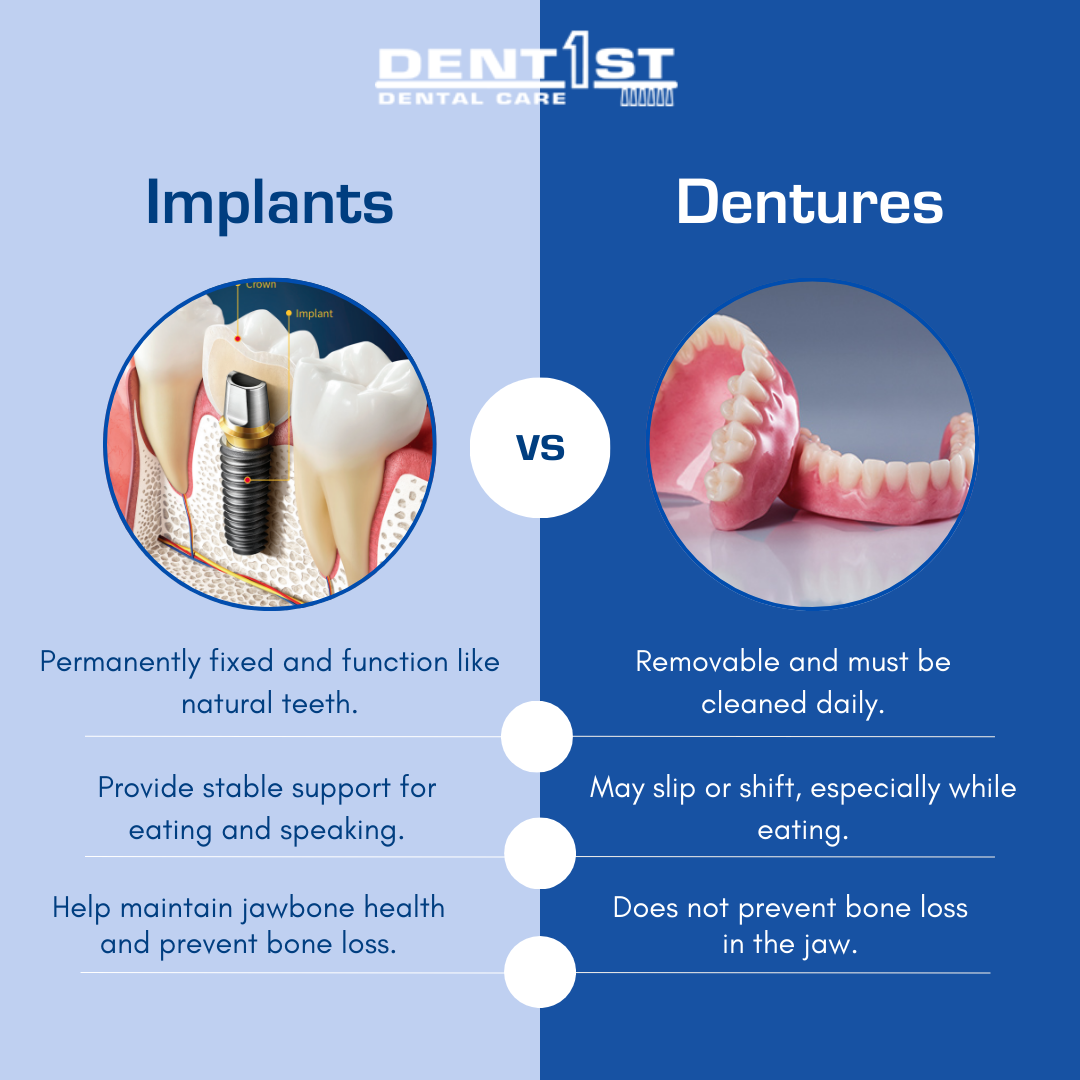Dental Implants, Dentures, and Implant Patients: What You Should Know