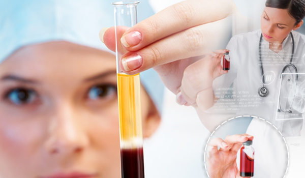 PRP Injection in Beverly Hills & LA for Regenerative Care