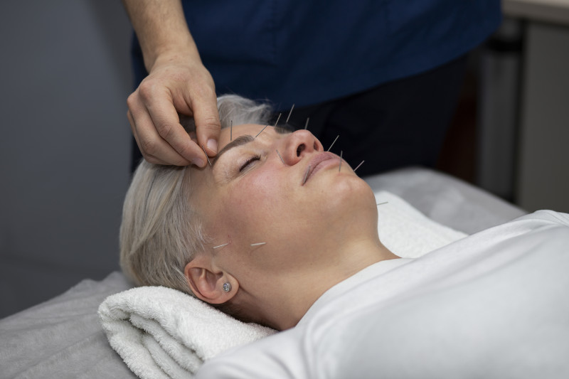 Acupuncture for Chronic Pain Relief: How Migraines, Sciatica, and Arthritis Can Be Managed Naturally: ext_6990529 — LiveJournal