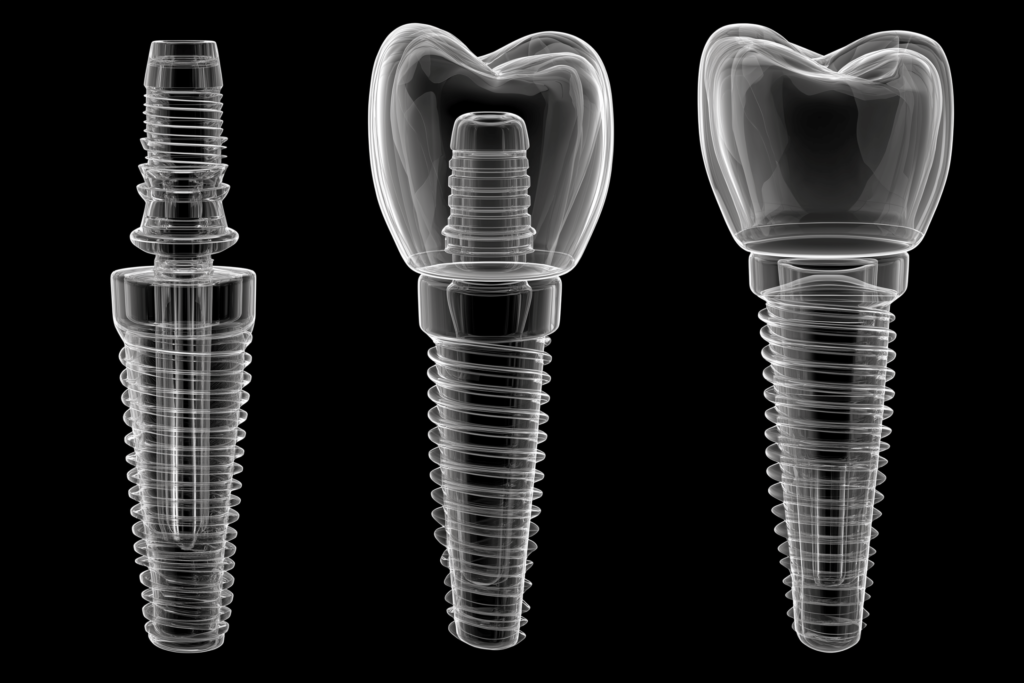 Best Dental Implant Clinic In Noida: Services, Expertise And Patient Care