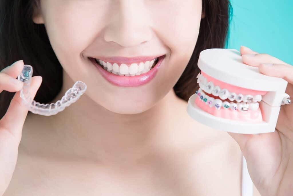 Are Smilers Clear Aligners Worth It? Complete Guide