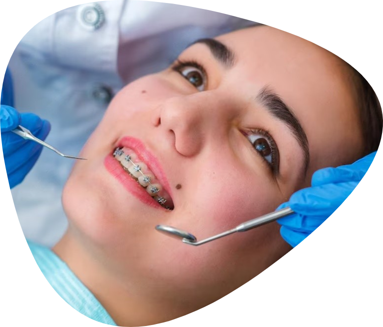 Dental Braces & Aligners - Shree Dental