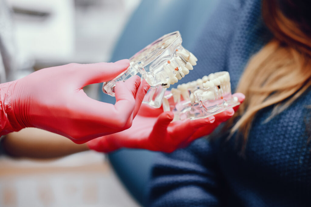 Dentures Implants Recovery : What to Expect After Treatment?