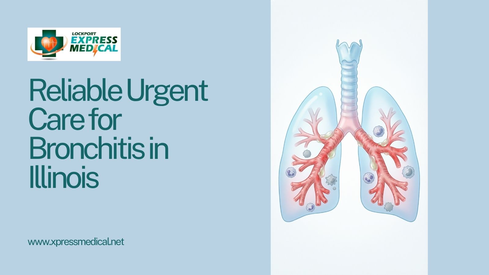 Urgent Care for Bronchitis in Lockport IL