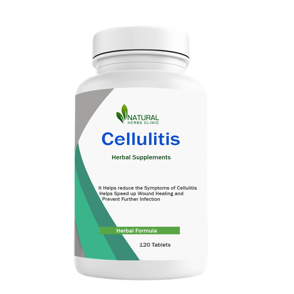 Herbal Treatment for Cellulitis | Natural Herbs Clinic