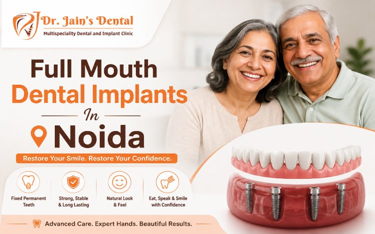 Are Full Mouth Dental Implants Suitable for Older Adults?